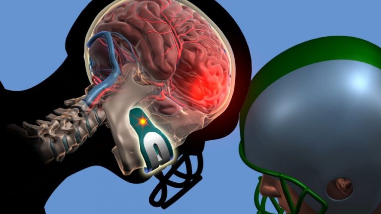 mouthguard-tease-02032018